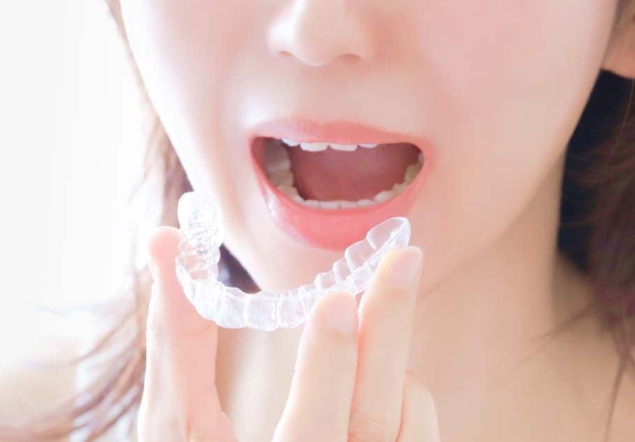 マウスピース矯正